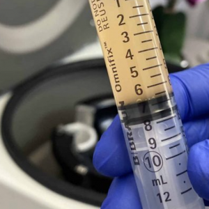 Platelet Rich Plasma (PRP) Spine Injections - San Diego Regenerative ...